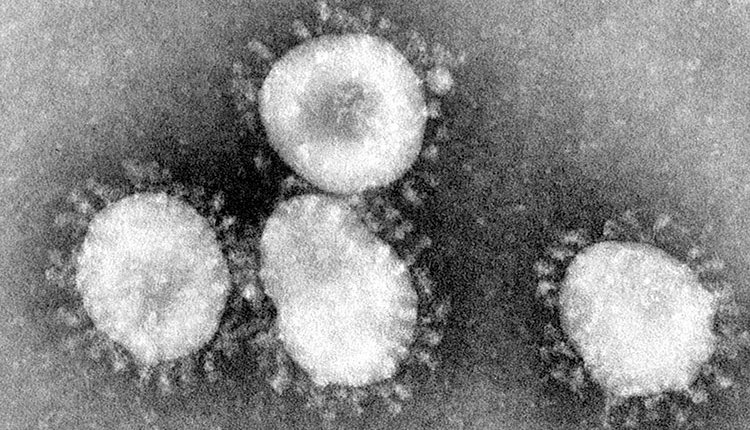 200325-181-coronavirus