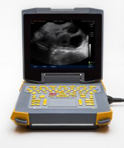 Ibex ultrasound
